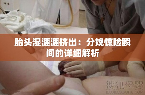 胎头湿漉漉挤出：分娩惊险瞬间的详细解析